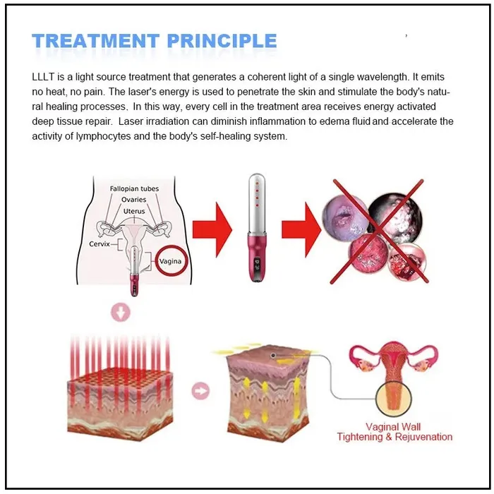 Laser Light Therapy Vagina Tightening Health Wand ShhhAlib Male Sex Toys